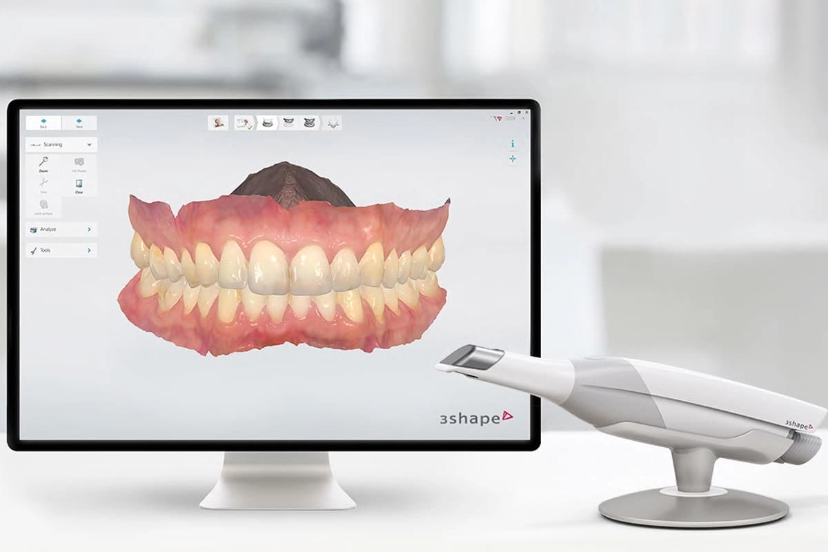 Escáner Intraoral Digital