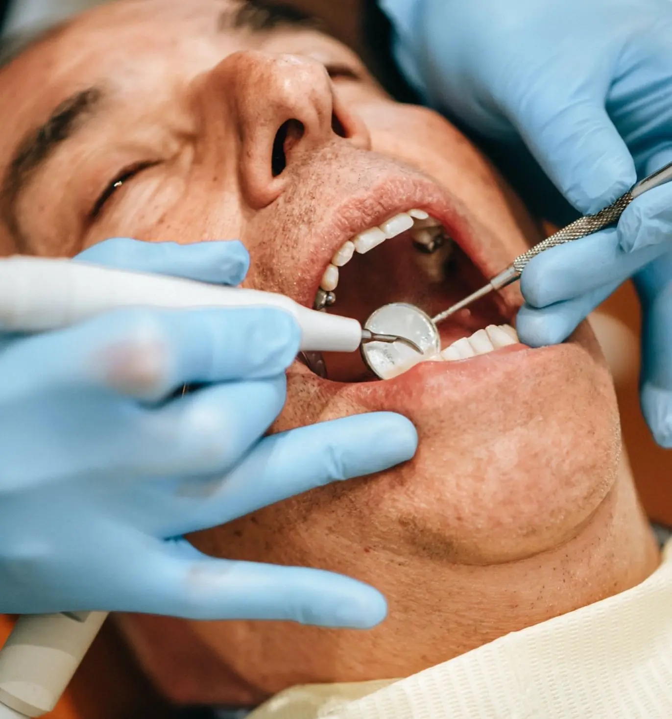 Implantes Dentales